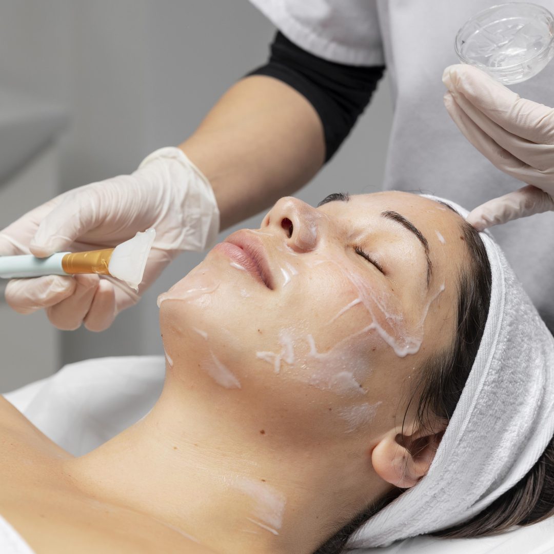 PEELING QUÍMICO